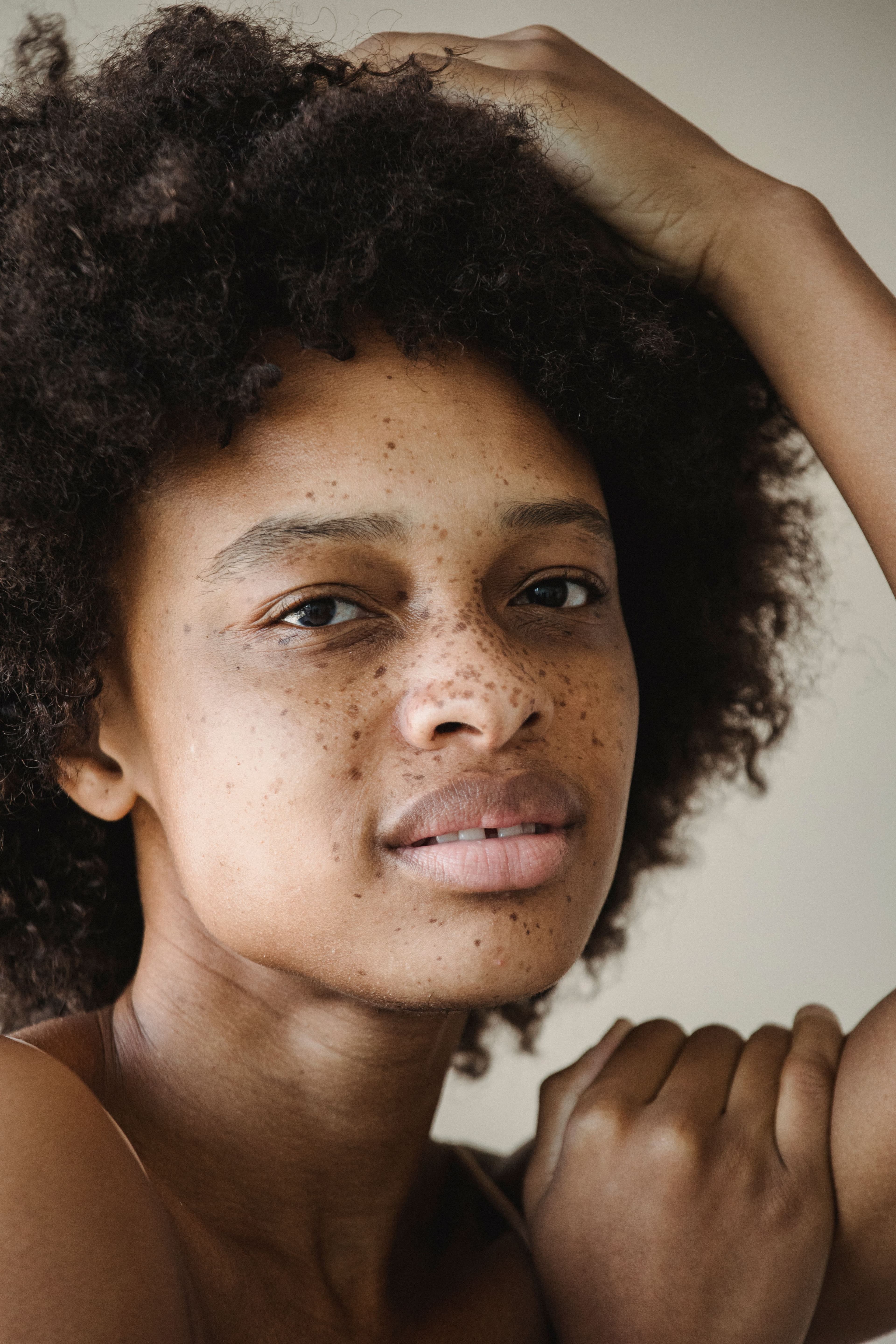 Pigmentation